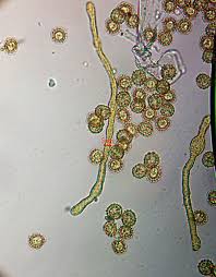 Attēlu rezultāti vaicājumam “Oligonema sp.”