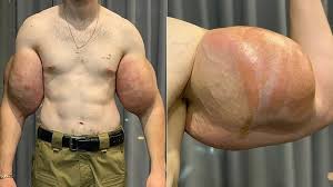 Image result for SYNTHOL