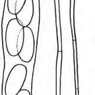 Attēlu rezultāti vaicājumam “Ophiostoma polyporicola”