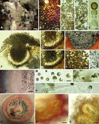 Attēlu rezultāti vaicājumam “Lichenoconium xanthoriae”