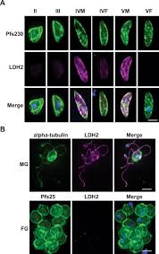 Attēlu rezultāti vaicājumam “Oligonema favogineum plasmodium”