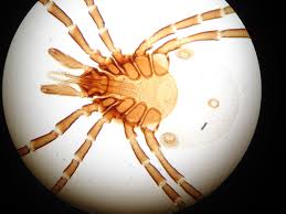 Attēlu rezultāti vaicājumam “Ixodes female”