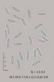 Attēlu rezultāti vaicājumam “Mollisia amenticola”