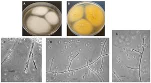 Attēlu rezultāti vaicājumam “Akanthomyces aculeatus”
