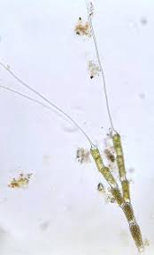 Attēlu rezultāti vaicājumam “Bulbochaete mirabilis”