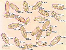 Attēlu rezultāti vaicājumam “Sarcoscypha austriaca var. lutea”