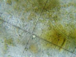 Attēlu rezultāti vaicājumam “Chaenotheca trichialis”