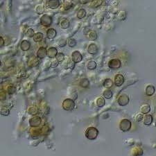 Attēlu rezultāti vaicājumam “Chaenotheca trichialis”