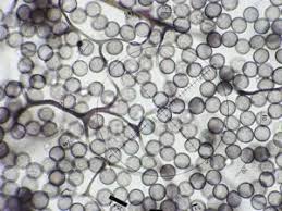 Attēlu rezultāti vaicājumam “Stemonitis flavogenita spores”