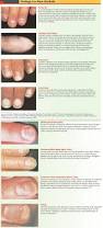 Image result for lunula nail