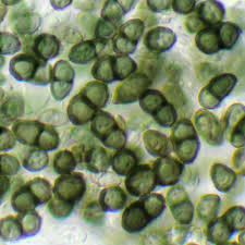 Attēlu rezultāti vaicājumam “Calicium viride”