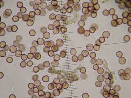 Attēlu rezultāti vaicājumam “Physarum confertum spores”