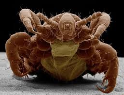 Attēlu rezultāti vaicājumam “Pediculus humanus capitis”