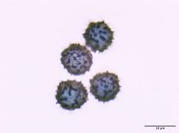 Attēlu rezultāti vaicājumam “Stemonitopsis typhina spores”