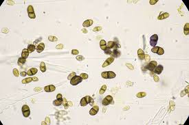 Attēlu rezultāti vaicājumam “Calicium viride”