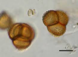 Attēlu rezultāti vaicājumam “Cribraria rubiginosa spores”