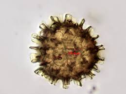 Attēlu rezultāti vaicājumam “Fossombronia wondraczekii spores”