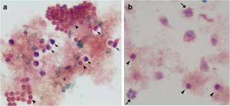 Attēlu rezultāti vaicājumam “Colloderma sp.”