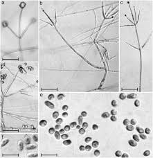 Attēlu rezultāti vaicājumam “Trichia erecta spores”