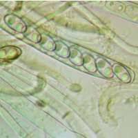 Attēlu rezultāti vaicājumam “Peziza badia”