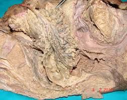 Image result for b%FD%E7ak anatomisi