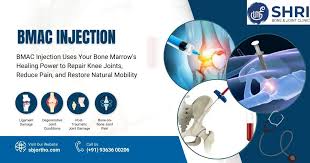 Image result for BMAC