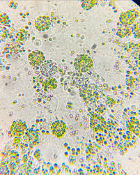 Attēlu rezultāti vaicājumam “Spongilla lacustris”