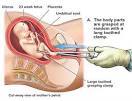 How many abortions are there every day?