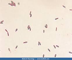 Attēlu rezultāti vaicājumam “Claustria didermoides spores”