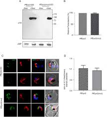 Attēlu rezultāti vaicājumam “Dianema depressum plasmodium”