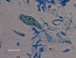 Attēlu rezultāti vaicājumam “Microcalicium disseminatum”
