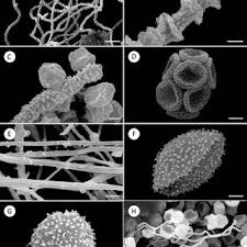 Attēlu rezultāti vaicājumam “Arcyria helvetica stalked”