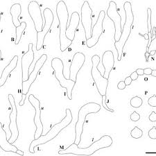 Attēlu rezultāti vaicājumam “Biatoropsis usnearum”