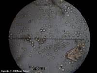 Attēlu rezultāti vaicājumam “Arcyria stipata spores”