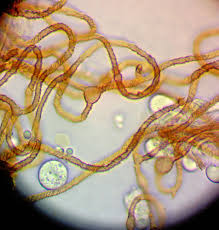 Attēlu rezultāti vaicājumam “Hemitrichia sordivesiculosa”