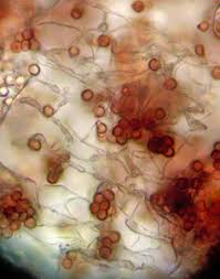 Attēlu rezultāti vaicājumam “Physarum bryomacrocarpum”