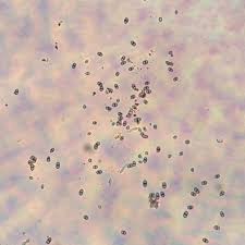 Attēlu rezultāti vaicājumam “Chaenotheca brunneola”