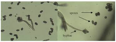 Attēlu rezultāti vaicājumam “Comatricha meandrispora spores”