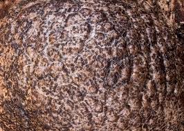 Attēlu rezultāti vaicājumam “Lycogala roseosporum spores”