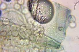 Attēlu rezultāti vaicājumam “Arcyria affinis young”