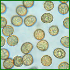 Attēlu rezultāti vaicājumam “Cribraria rufa spores”