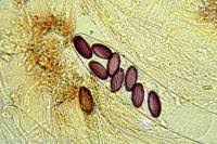 Attēlu rezultāti vaicājumam “Ascobolus furfuraceus”