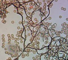 Attēlu rezultāti vaicājumam “Lycogala cf. oleocrystalliferum”