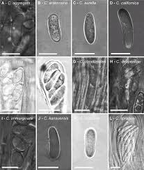 Attēlu rezultāti vaicājumam “Candelariella sp.”