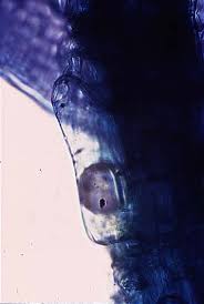 Attēlu rezultāti vaicājumam “Sphagnum centrale sporophyte”