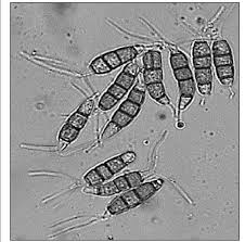 Attēlu rezultāti vaicājumam “Stemonitopsis aequalis var. microspora spores”
