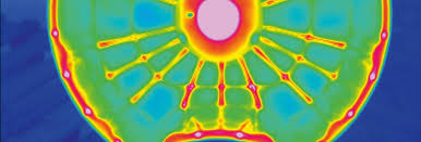 Image result for thermographie-aufnahmen