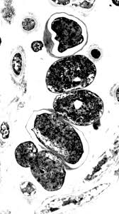 Attēlu rezultāti vaicājumam “Nostoc pruniforme cells”