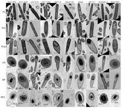 Attēlu rezultāti vaicājumam “Enteridium liceoides spores”