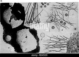 Attēlu rezultāti vaicājumam “Didymium difforme macro”